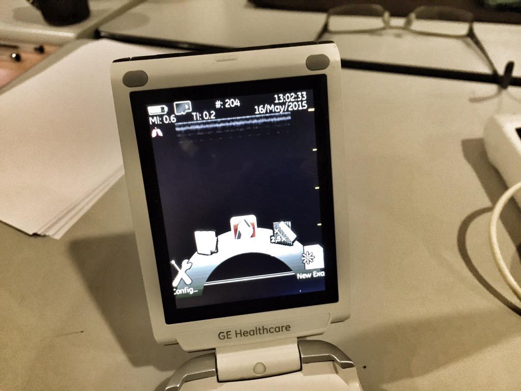 NicolasLoubet's tweet image. [Pic] #echopen Focus sur l'interface de la sonde ultra-portable de GE.