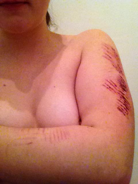 DepressedN0RTH's tweet photo. Oops I did it again #triggerwarning http://t.co/TsHBccJxD4