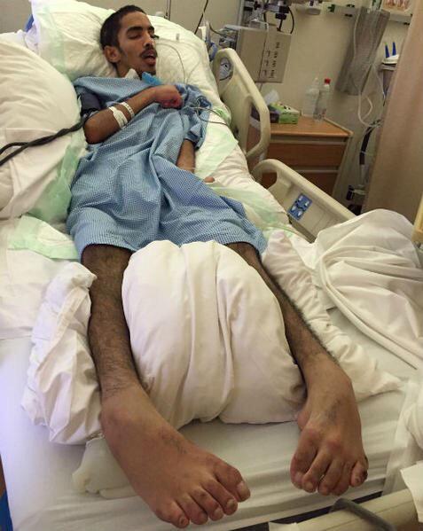 News_Brk24's tweet photo. نداء 🔴 عاجل

رجل أمن يتعرض لحادث مروري في #الطائف،ويفقد وعيه لثلاثة أشهر، ووالده يناشد نقله للمستشفى العسكري بـ #جدة. http://t.co/VyQk0E1rf9