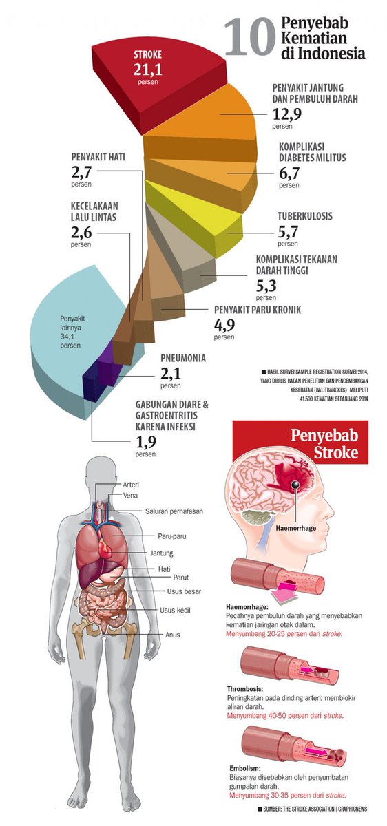 anjarisme's tweet photo. STROKE, penyebab kematian tertinggi di Indonesia | cc. @puskomdepkes @blogdokter @dedeyusuf_1 @saya_noriyu http://t.co/59VJAubCJs