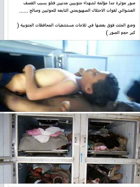 #عدن 
احصائية: مقتل 517 شخصاً بينهم 76 امرأة و 3461 جريحاً برصاص مليشيا الحوثي وصالح بعدن