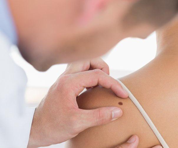 Melanoma Day at the EMC emcmos.ru/en/profession/…
#EMC #GEMC #melanoma #healht