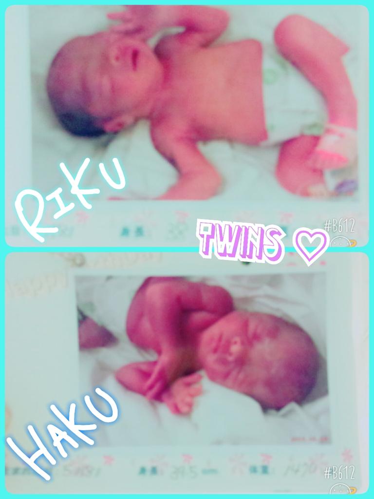 0nlySn's tweet photo. 5/18 約2ヶ月早く緊急手術で出産😭💓
利煦👦りく1280g 覇悾👦はく1470g です🌼小さいけど元気に泣いて生まれてきてNICUけど何もなく元気💞何度も緊急手術かもを乗り越えてきてくれました💗どっちに似かわまだけど顔は一緒😳 http://t.co/dMVLJX1WGM