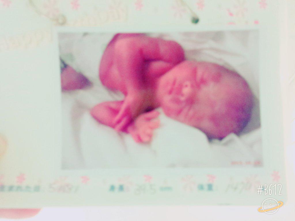 0nlySn's tweet photo. 5/18 約2ヶ月早く緊急手術で出産😭💓
利煦👦りく1280g 覇悾👦はく1470g です🌼小さいけど元気に泣いて生まれてきてNICUけど何もなく元気💞何度も緊急手術かもを乗り越えてきてくれました💗どっちに似かわまだけど顔は一緒😳 http://t.co/dMVLJX1WGM