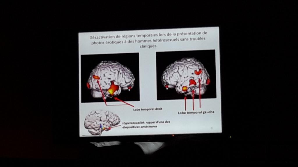 FlashCordon's tweet photo. On a enlevé les lobes temporaux à des singes. Ils sont devenus hypersexuels. Ces lobes sont des inhibiteurs #PoSfr http://t.co/PxKFEGDcfR