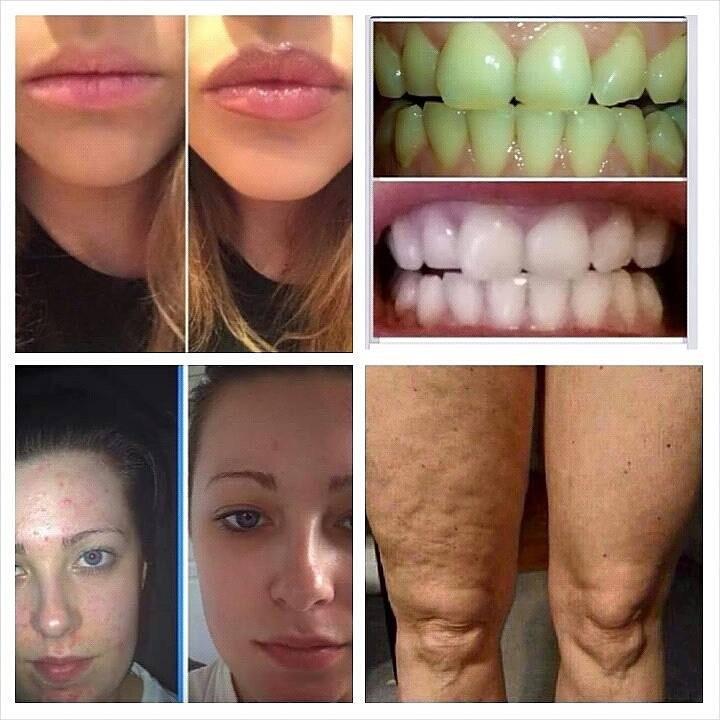 SingleParentsOn's tweet image. I'm looking to recruit Mums and Dads that want to work from home retailing AMAZING products pm me for more info.