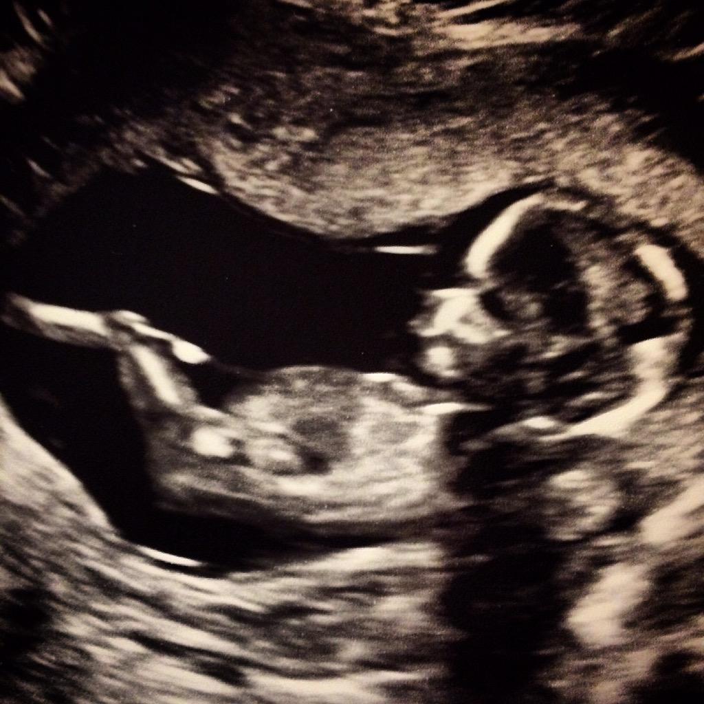 ckoher's tweet photo. Just chillin' it 😎👶🏼 http://t.co/bZhjMKY1QK