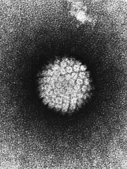 Microscopia electronica de un Virus del Papiloma Humano