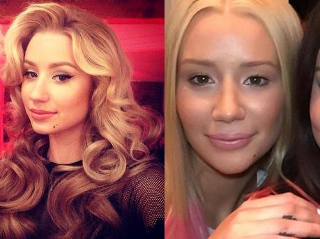 AzanyIAm's tweet image. Qu'est-il arrivé au visage d'@IggyAzalea ? O_o ➝ bit.ly/1QXpEPl @SkyrockOfficiel