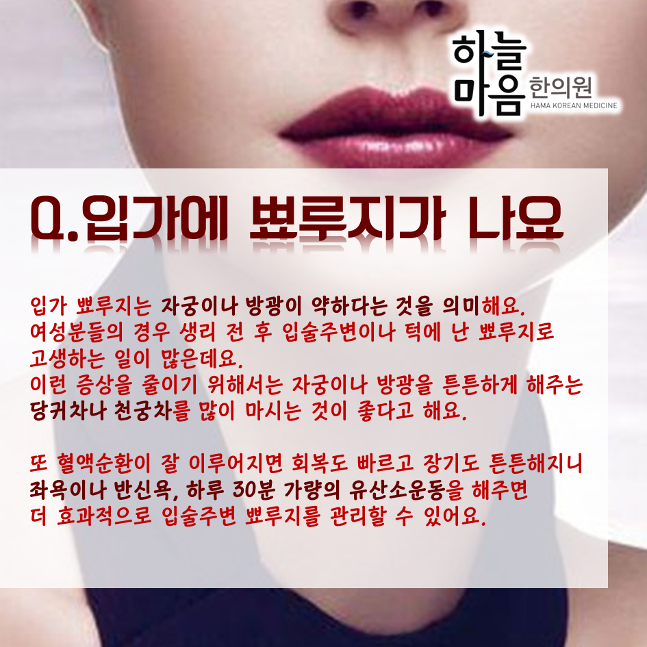 skin8575's tweet photo. #입술 #입술미녀 #입술미남 에 관심있는 분들 집중!
#하늘마음한의원 이 알려주는 입술관리법!
#헤르페스 입가 #뾰루지 입술 #건조함 까지~ http://t.co/yHfbhCGRFA