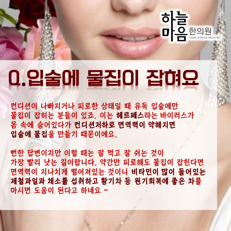 skin8575's tweet photo. #입술 #입술미녀 #입술미남 에 관심있는 분들 집중!
#하늘마음한의원 이 알려주는 입술관리법!
#헤르페스 입가 #뾰루지 입술 #건조함 까지~ http://t.co/yHfbhCGRFA