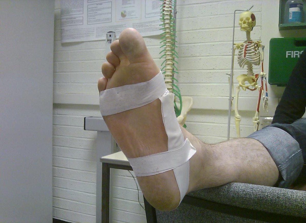 LBG_Medical's tweet photo. In her latest blog Heidi Meckler talks about the role of taping and its different techniques.http://t.co/unRx43fVJq http://t.co/snaWF5iE6G
