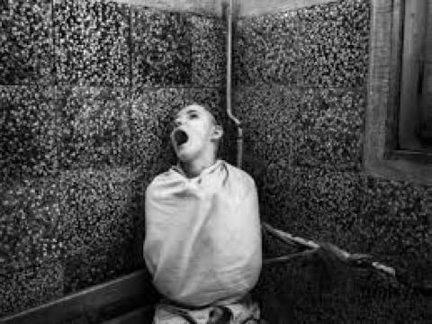The 20 Craziest Medical Experiments Ever Done serve.im/316.3e4