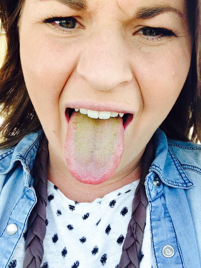 itsbrittfitz's tweet photo. Signs of eating too healthy: green tongue. #juicingproblems http://t.co/oERdzuDOTT