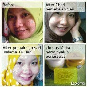 mawarntShop's tweet photo. wajah putih, bebas jerawat, flek hitam dan komedo?? yuk pake cream sari BPOM, Pin:51CC3732 / 081264806992 http://t.co/W2ArZwXUBz