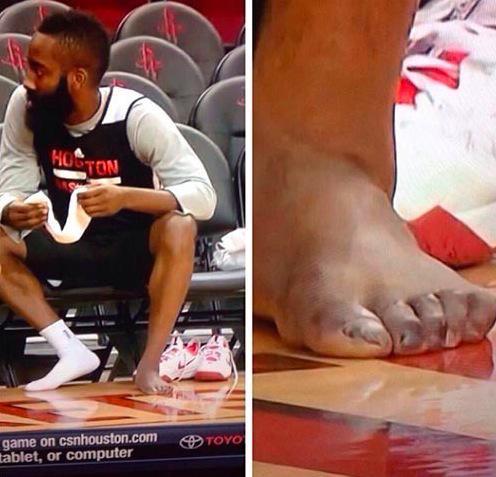 NBA球星的「戰腳」有多另類?詹姆斯腳趾像外星人,哈登像怪獸!-黑特籃球-NBA新聞影音圖片分享社區