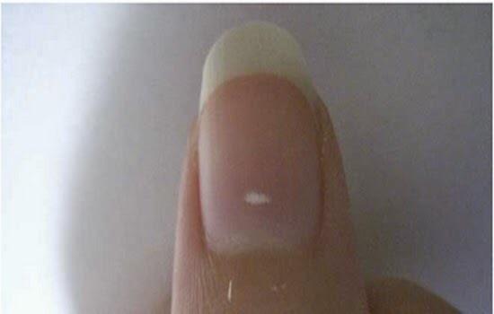 вертикальная дорожная разметка 2. что обозначает белая полоска. что обозначает белая полоска. флаг греции 1936. 11.