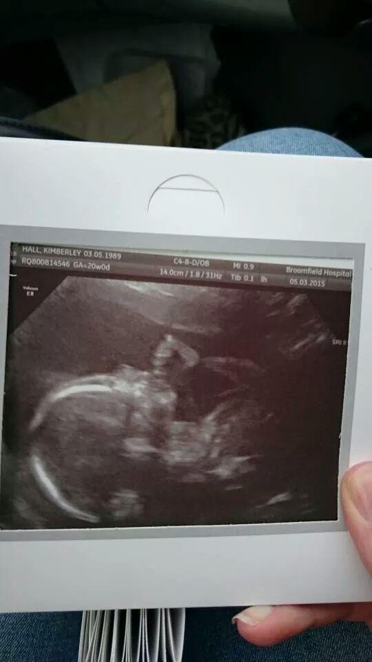 Kimberley Hall tweet media