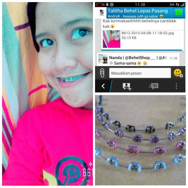 BehelShopID's tweet photo. Behelnya CANTIK!😙 
trusted klo orderdisini 
behel lepas pasang 125 rb atasbawah lengkap
FREEONGKIR!💜
pin 55381d46 http://t.co/TVn23u9Iox