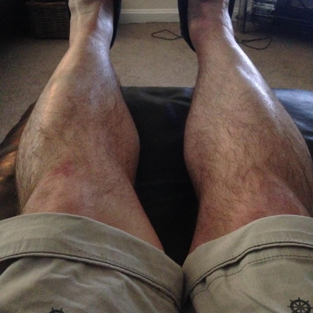 Pete Allinson tweet media