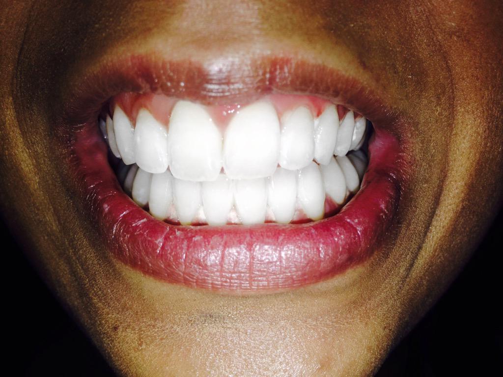 WhiteLabelTeeth tweet picture