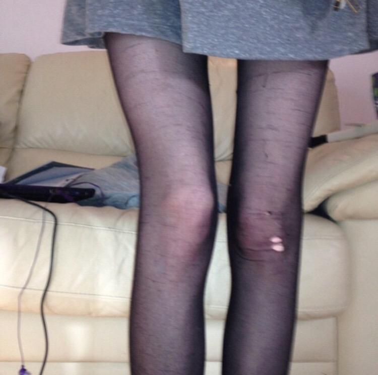 skinnyanorexic tweet picture