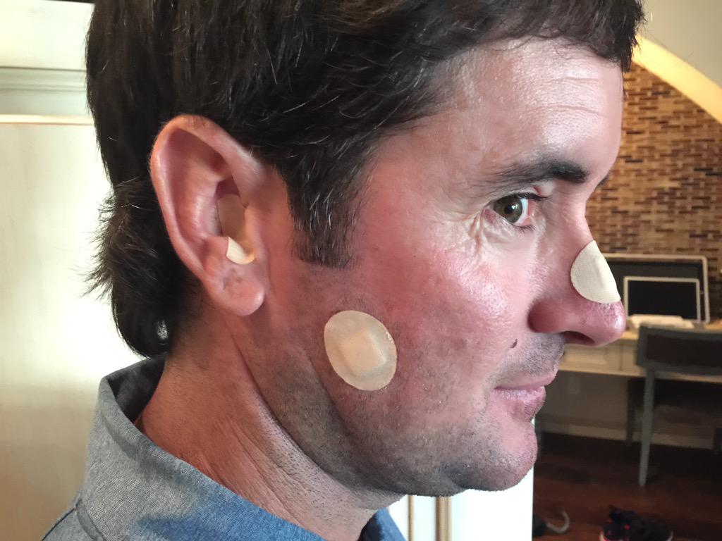 bubbawatson's tweet photo. Just got back from the dermatologist... had a few spots checked but all good! Be safe and get checked! #sunscreen http://t.co/bLdZQEAxxV