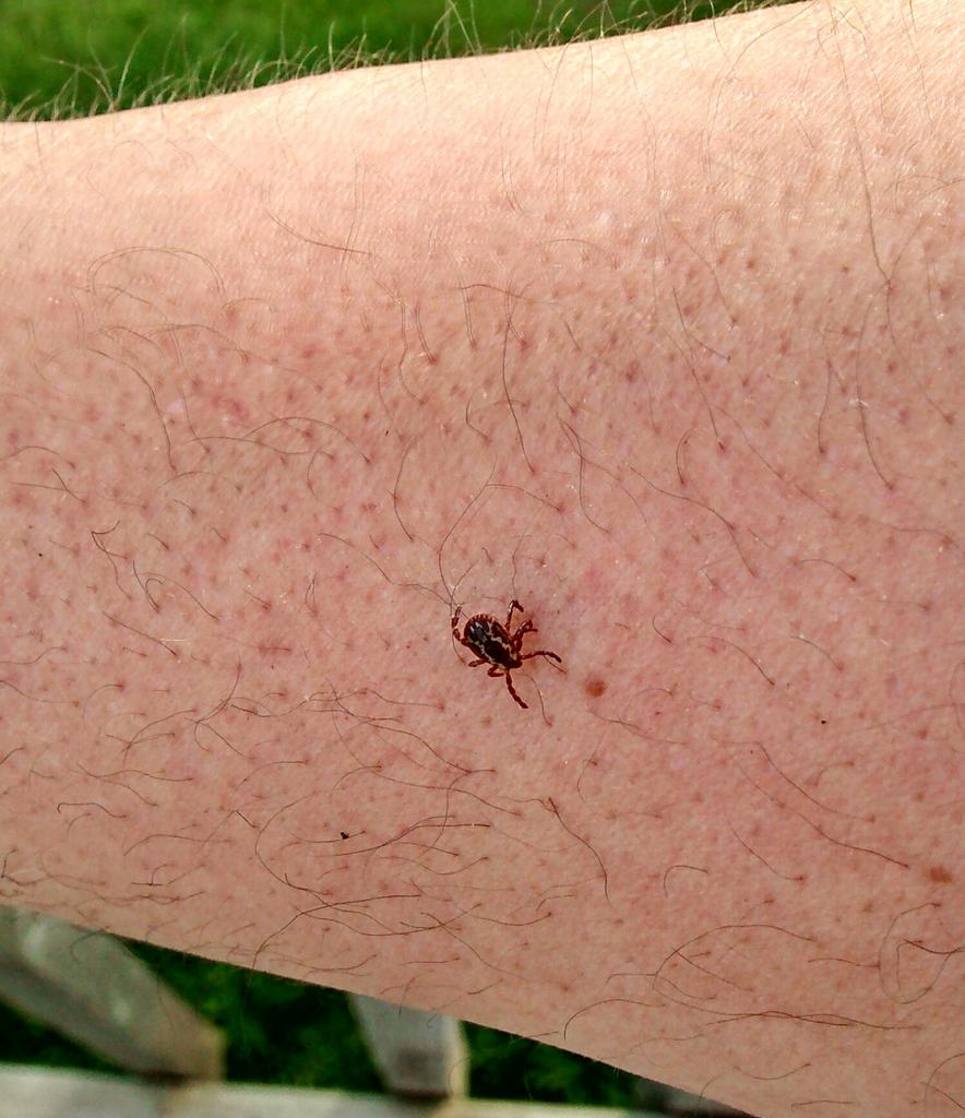 me_nobodyreally's tweet image. @TBDHealthUnit ..one more, makes 4 today. #ticktime #bugjacket time! #tbay