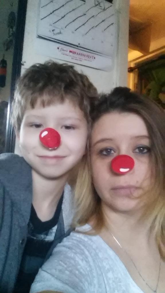 Little101M's tweet photo. #RedNoseDay http://t.co/YUVdHg9nnh
