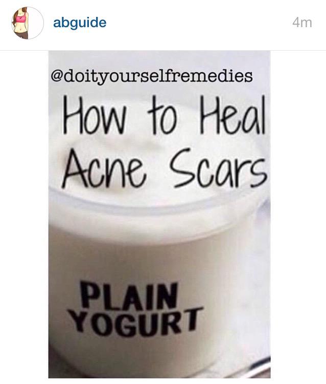 monthepole's tweet photo. @FUDGINBlueFudge if #plainyoghurt heals acne scars what can #greekyogurt do? 🙊  cure #bluefudge? http://t.co/X5HI53k4PZ