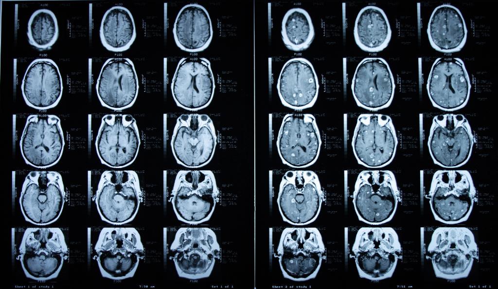 JAMA Oncology tweet media