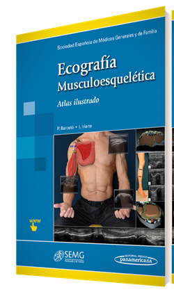 carlespedret's tweet photo. Ecografía musculoesquelética. Imprescindible. @SEMG_ES @inigoiri #PabloBarceló #RamonBalius @carlespedret #Permanyer http://t.co/9O5SjOdDOA