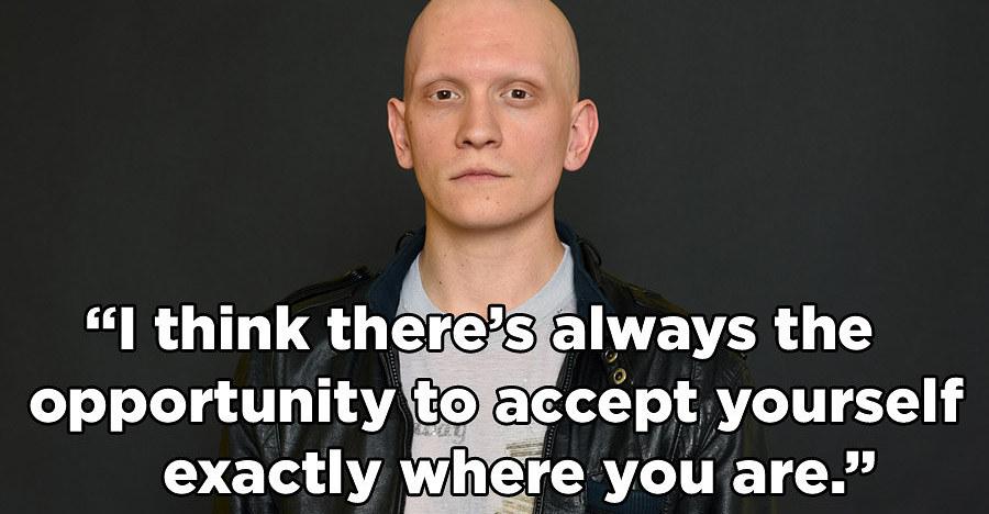 viralturn's tweet photo. #AnthonyCarrigan #BodyPositivity #Bodyweek #Selflove "Gotham's" Anthony Carrigan ... - http://t.co/oXIUwAsS0G http://t.co/XxOpQZhwkT