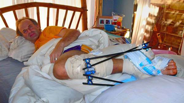 How does @HansNoWayRey deal with injuries? themountainbikelife.com/2015/05/overco… @ColleenSBA