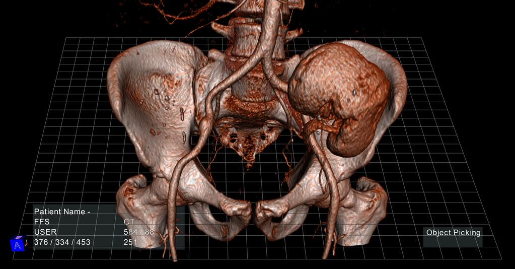 motherboard's tweet photo. Now doctors can see your guts in virtual reality: 
http://t.co/SV7Qunr1W8 http://t.co/fA7TqwFOPs