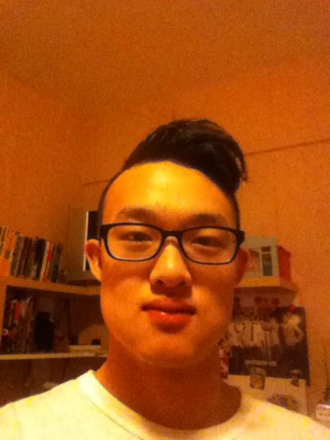 Calv_Kwan's tweet photo. Swelling day one. Funniest shit i ever seen of myself. I lie, im actually fat, not swelling http://t.co/cKPy2c8Gk0
