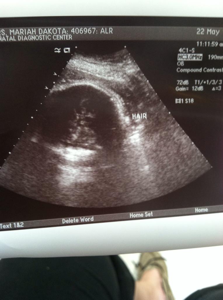 MariahRene__'s tweet photo. My baby girl has a head full of hair lol http://t.co/BoTnROXXjP