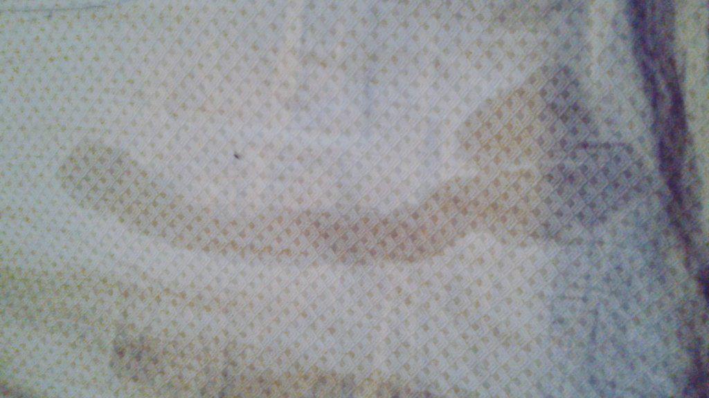 ChronicallyKush's tweet photo. Spilled soda on the sheets...  Just me or does it look like a side shot of a really thin d:ck? http://t.co/H2Ay53tgVe