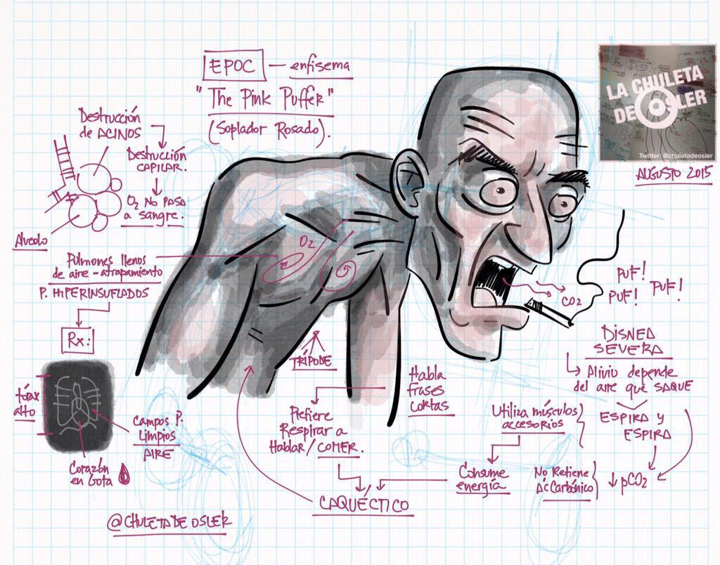 Respira fisioterapia , recordando datos básicos y fundamentales
