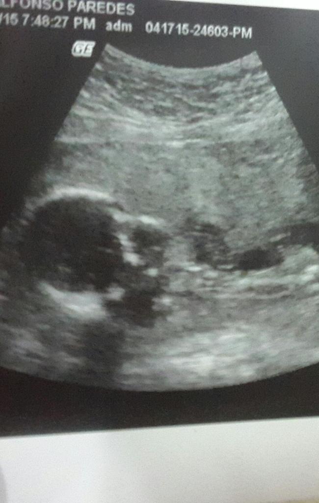 karengomezcoka's tweet photo. Mi 💓 amor chiquito #nuestrabendicion #familiaarana #bellomiosito http://t.co/Rfe0CoxEZ9