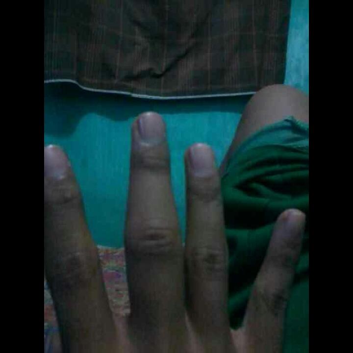 AmeliiaDella's tweet photo. Cepet sembuh damm😭😰kasian wkwk;(😂😂({})💋 http://t.co/VEfTAsw8Gw