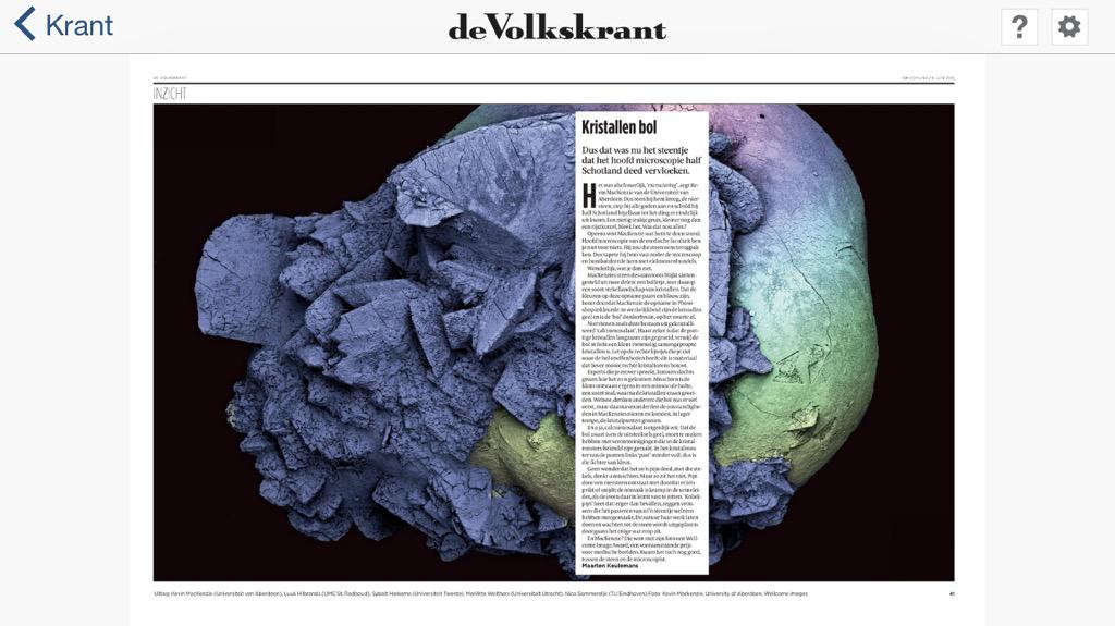 Een niersteen van héél dichtbij. 
Plus de opgedane kennis over kramp in de urineleider als oorzaak van de pijn.