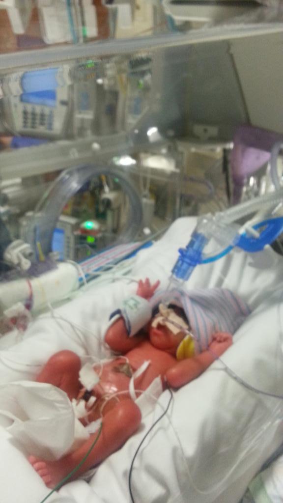 My grand daughter born 3 months early...shes fighting...were praying...granny LOVES u Ma'Kiyah Lanyce