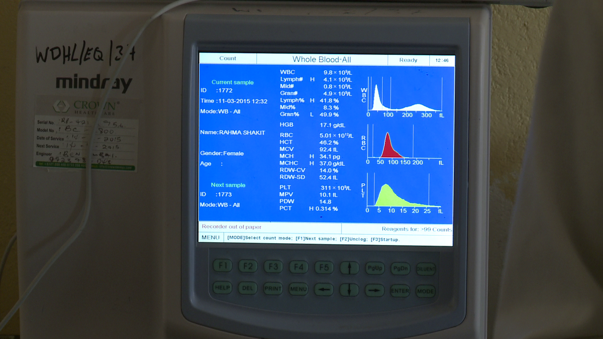 KenyaGovernors's tweet photo. #DevolvedHealth Biochem analysis equipment serves 5 patients & analyse 36 tests at a go in Wajir Referral Hosp. http://t.co/t9wQDDVSbb