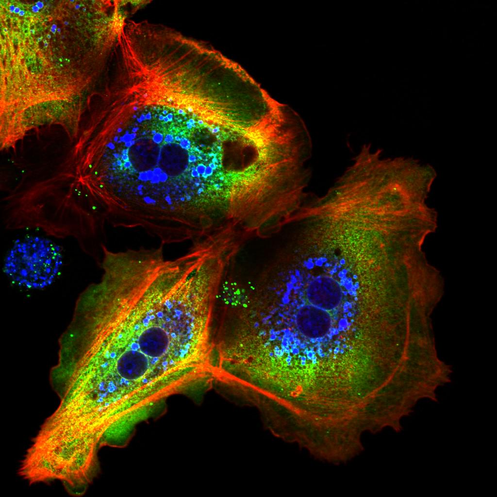 ImmunoP's tweet photo. beautiful #immunoprint http://t.co/JQO9vt1NwI