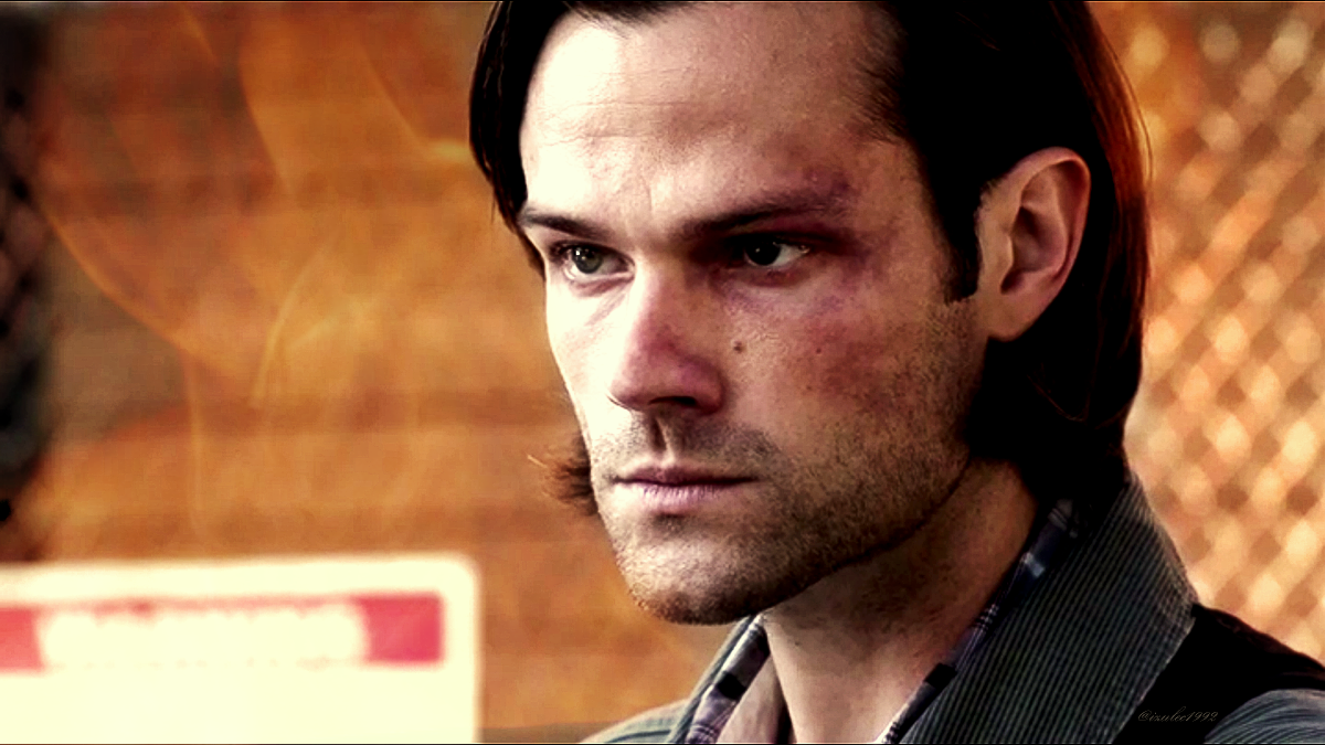Nobody should look so good with all these bruises, but Jared apparently doesn't know that...

#Supernatural