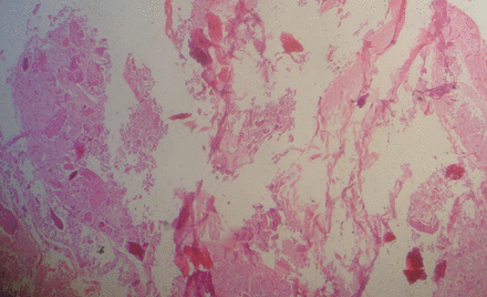 EchoResPract's tweet photo. Large isolated #hydatid #cyst of the #interventricular septum by Pourafkari et al.,
http://t.co/0PId8WXXQq http://t.co/PNHiB3MGCh