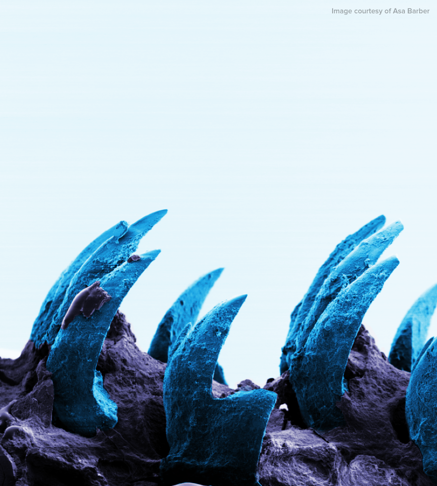 scifri's tweet photo. Limpet teeth are the strongest biological material discovered yet. http://t.co/eTrSeM6Gmx http://t.co/CWEd8eJxBZ