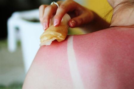 CanerOrgUa's tweet image. Советы для профилактики #рак #кожи. #Никотинамид может снизить риск развития рака кожи - cancer.org.ua/tips-for-preve…