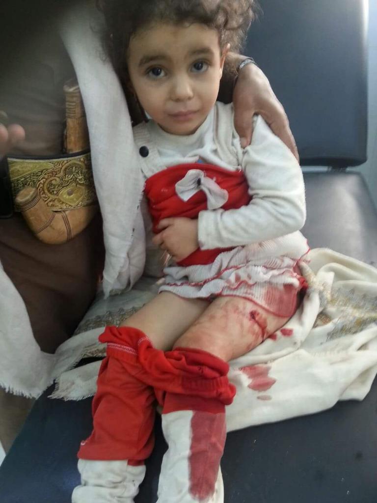 Mo_Alsalhi's tweet photo. جرائم الحوثيين ضد الأطفال في #مأرب بعد هزيمتهم في ارض المعركة قصفوا منازل المواطنين الأمنيين http://t.co/aXv5KSg47C